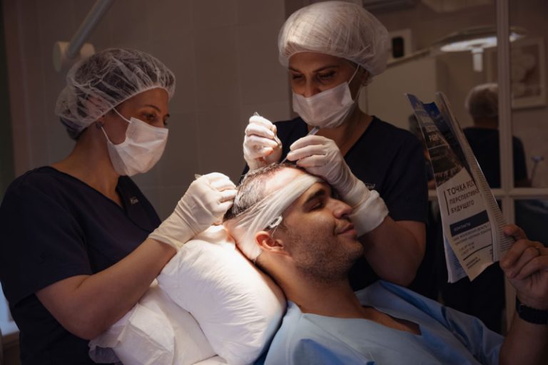 Современные методы пересадки волос для возвращения привлекательности